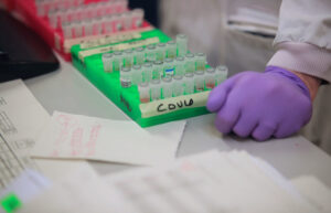 caso positivo de covid-19